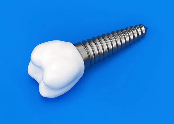 Dental Applications of PRP