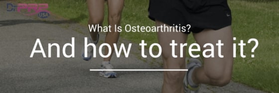 It’s A Shame If You Haven’t Tried PRP For Osteoarthritis [INFOGRAPHIC]