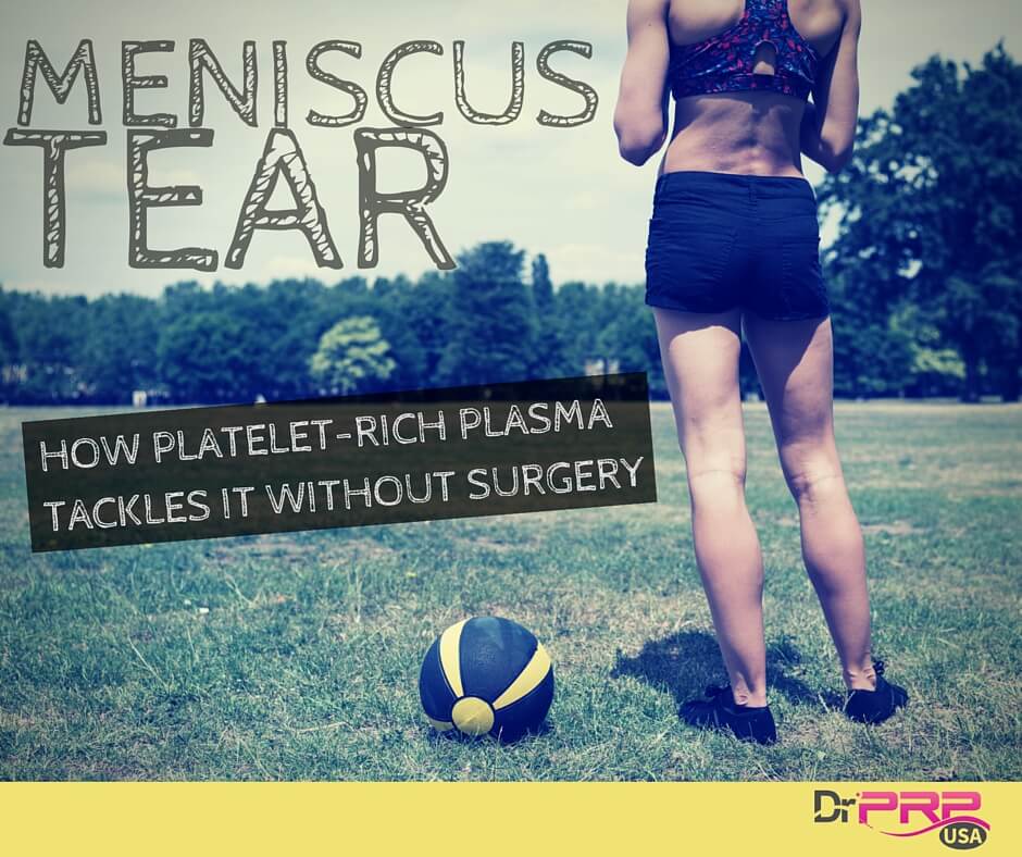 Meniscus Tears: How Platelet-Rich Plasma Tackles It Without Surgery [INFOGRAPHIC]