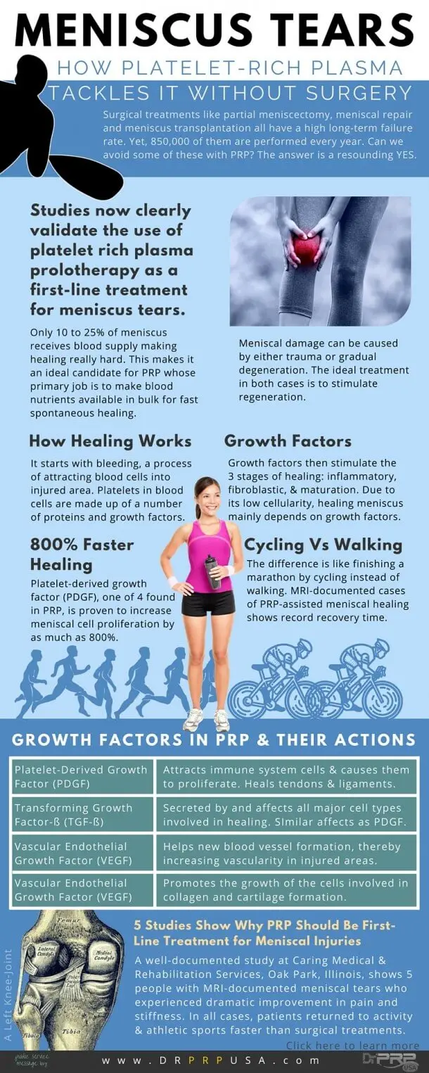 Meniscus Tears: How Platelet-Rich Plasma Tackles It Without Surgery [INFOGRAPHIC]