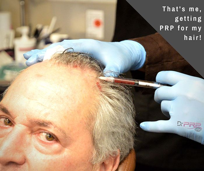 PRP Hair Treatment