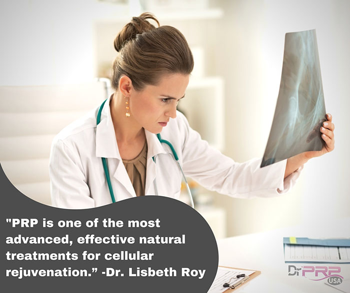 PRP is the most effective natural treatment for cellular rejuvenation