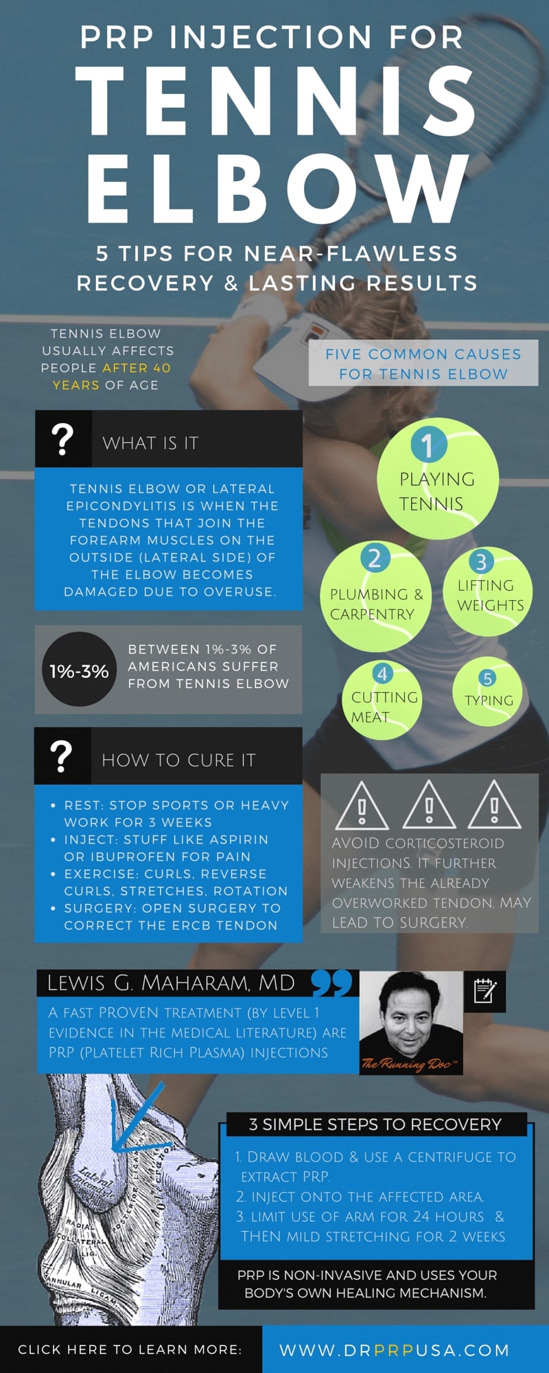 PRP Injection For Tennis Elbow: 5 Quick Tips [INFOGRAPHIC]