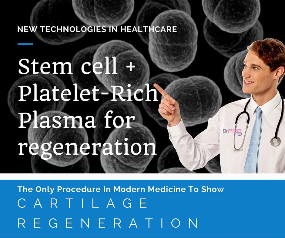 Stem Cell Platelet-Rich Plasma: The Best Regenerative Therapy?