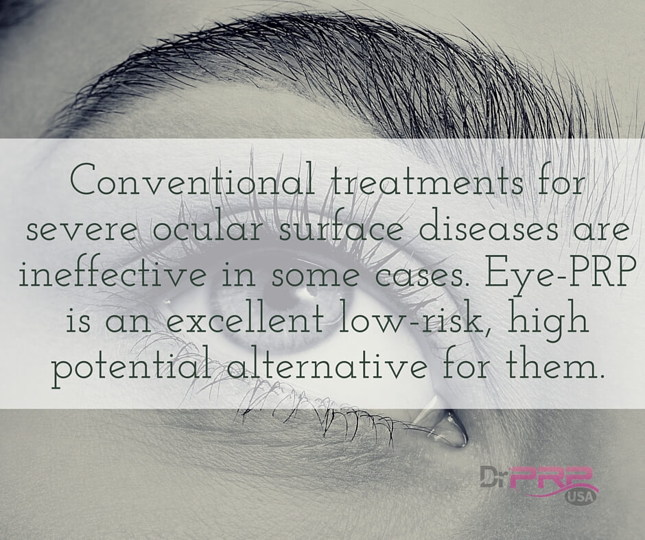 The Beauty Of Platelet-Rich Plasma For Dry Eyes