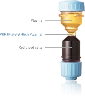 Dr. PRP Process