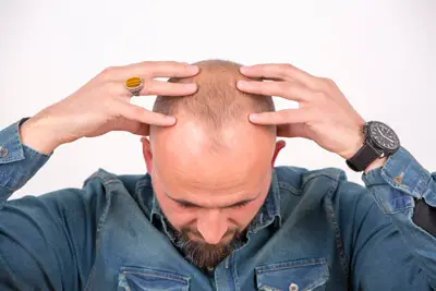 prp kits for hair growth
