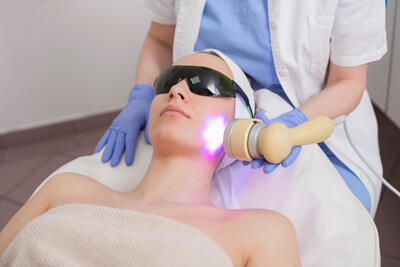 PRP after IPL therapy