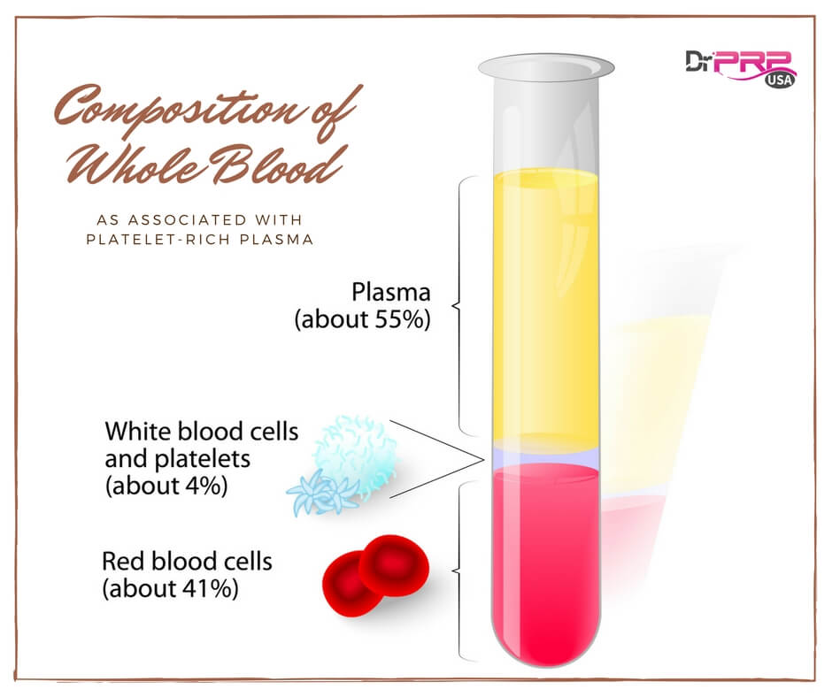Composition of Whole Blood as associated with PRP