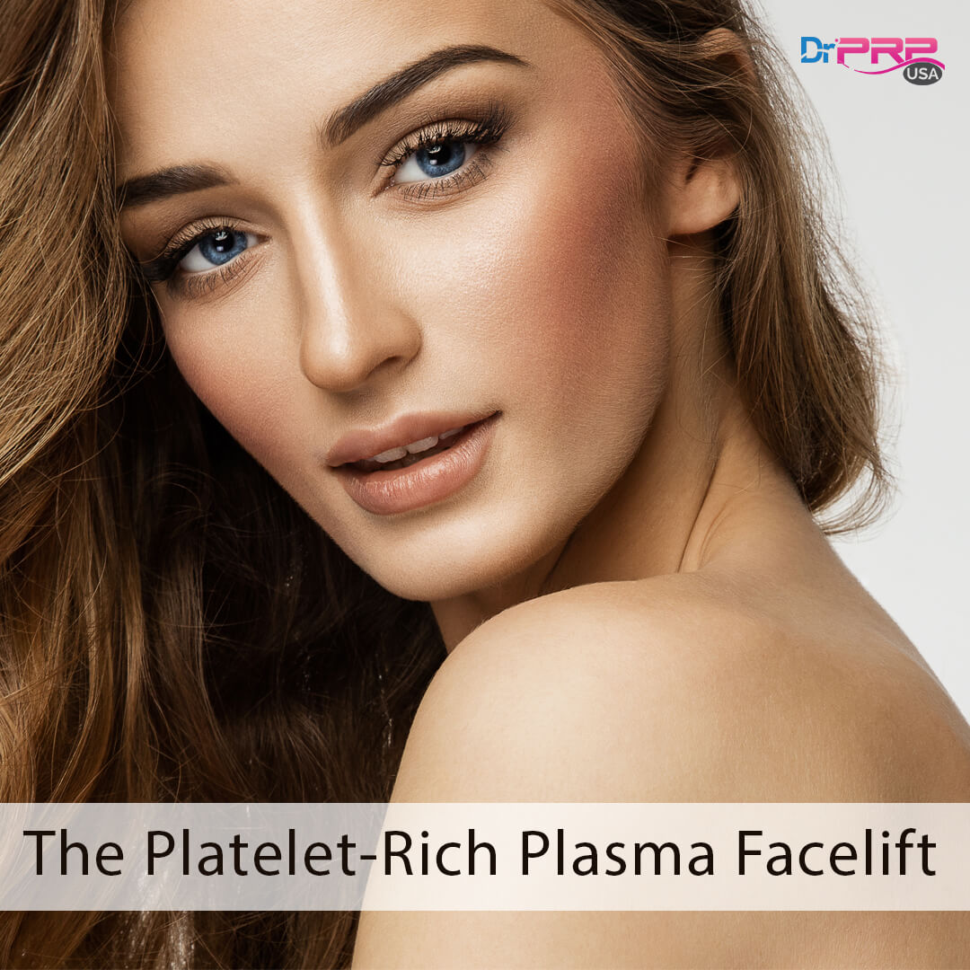 Platelet-Rich Plasma Facelift
