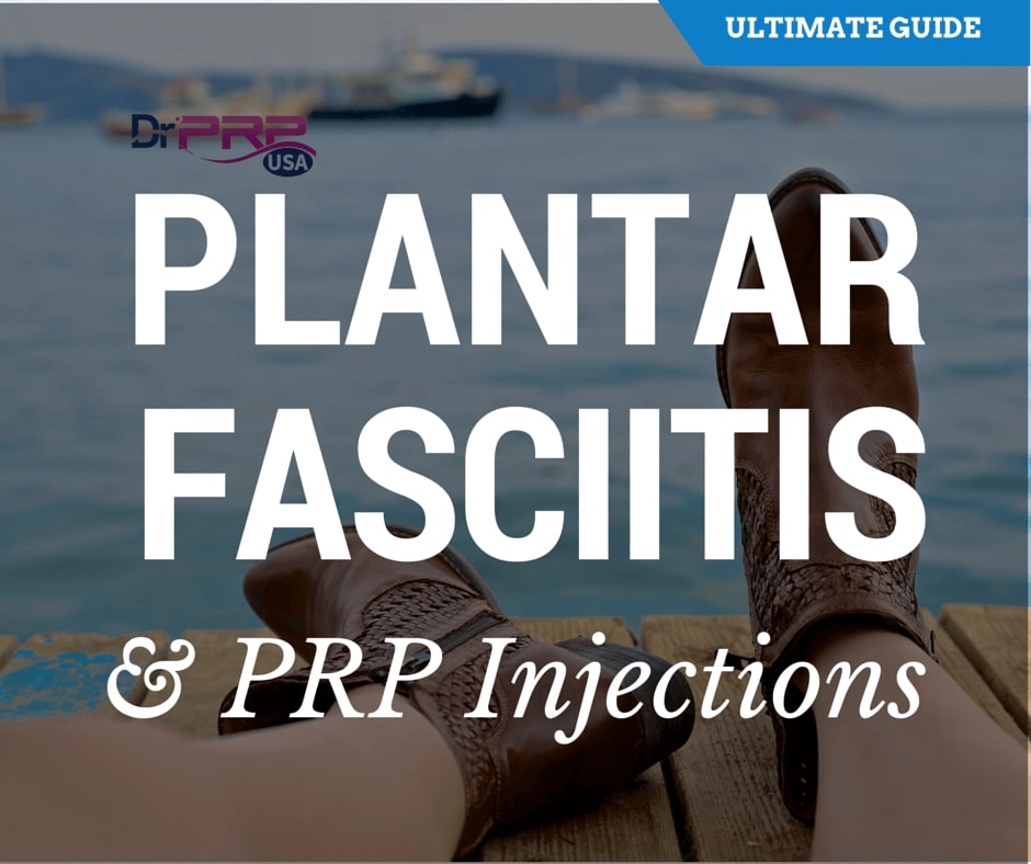 PRP Injection For Plantar Fasciitis: The Ultimate Guide [Infographic]