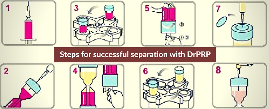 Steps for Successful Blood Separation using DrPRP PRP Kit