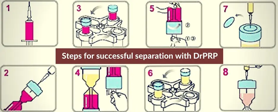Steps for Successful Blood Separation using Dr. PRP PRP Kit