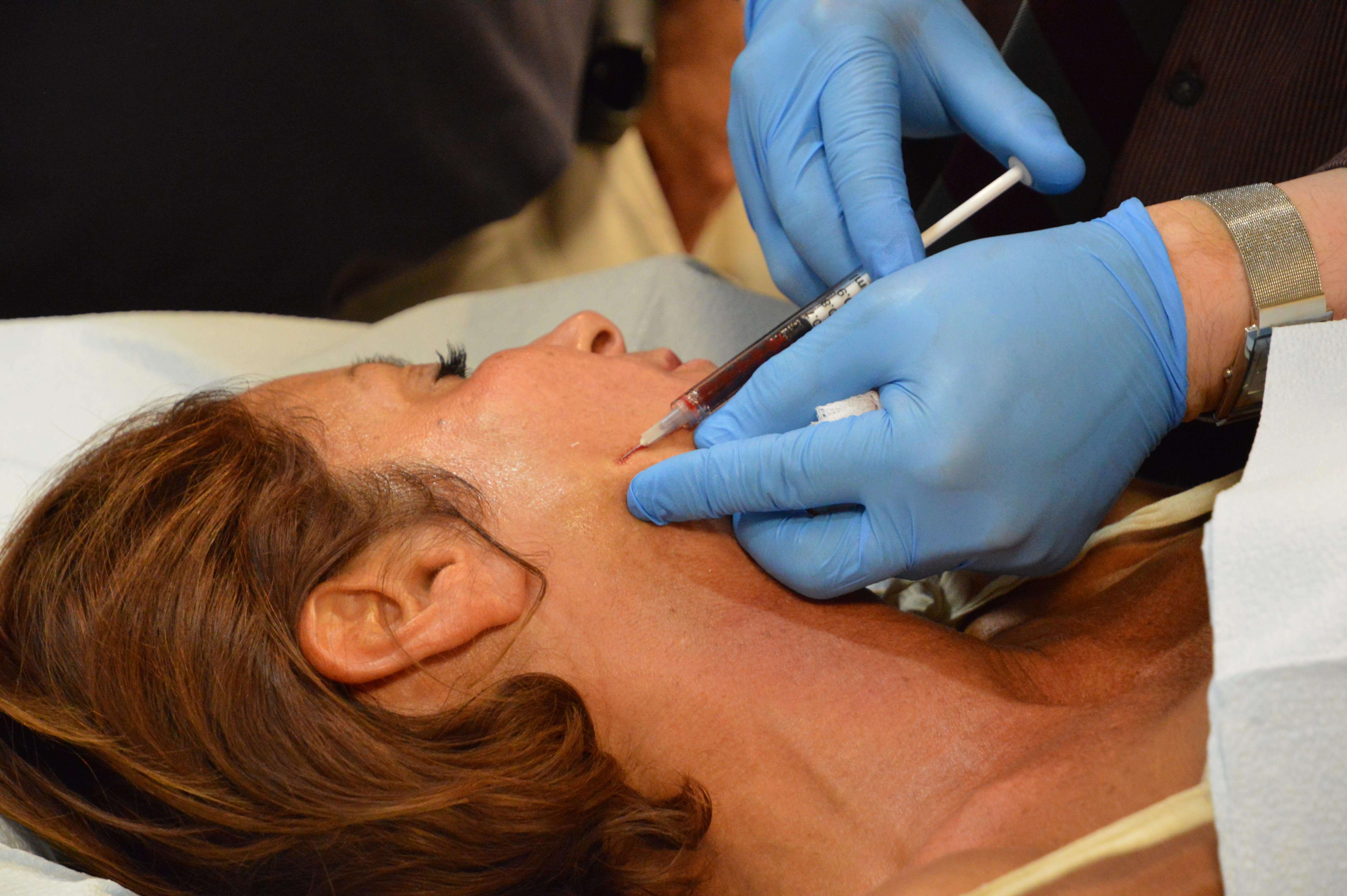 Esthetic Skin Institute picks Dr. PRP System Dr. PRP USA