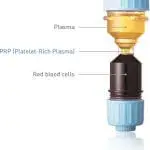 New Live Botox, Dermal Filler And Platelet-Rich Plasma Training