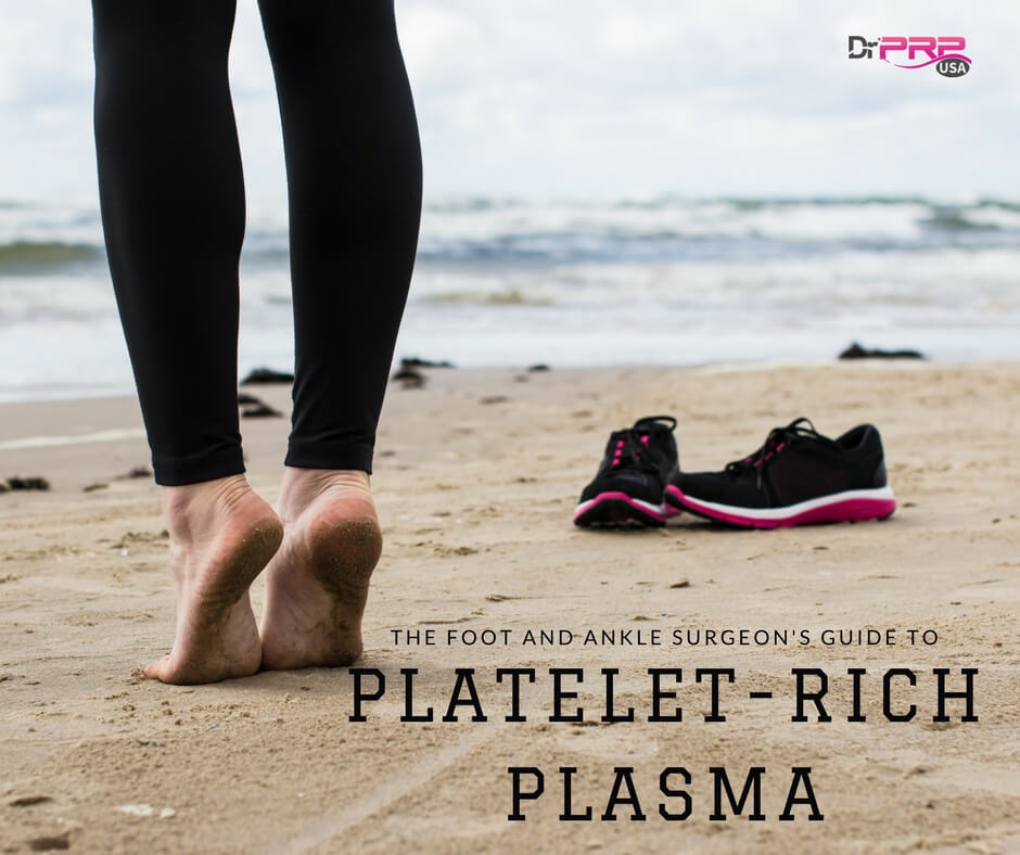 Foot And Ankle Surgeon’s Guide To Platelet-Rich Plasma