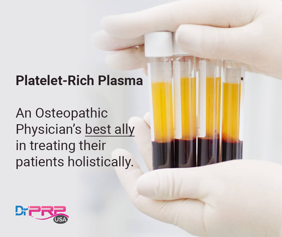 The Osteopathic Physician’s Guide to Platelet-Rich Plasma