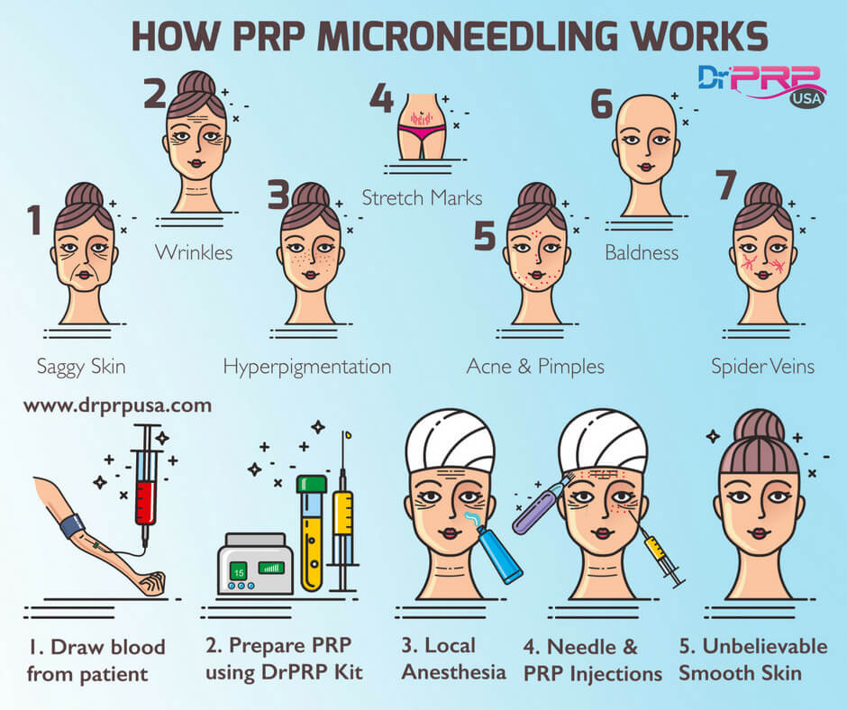 The Dermatologist’s Guide To PRP Hair Regeneration