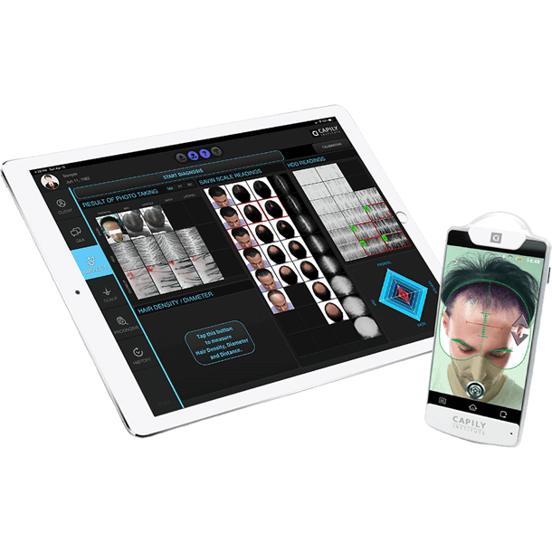 Hair Analysis Package (Hair Analysis Camera & Hair Analysis Software)